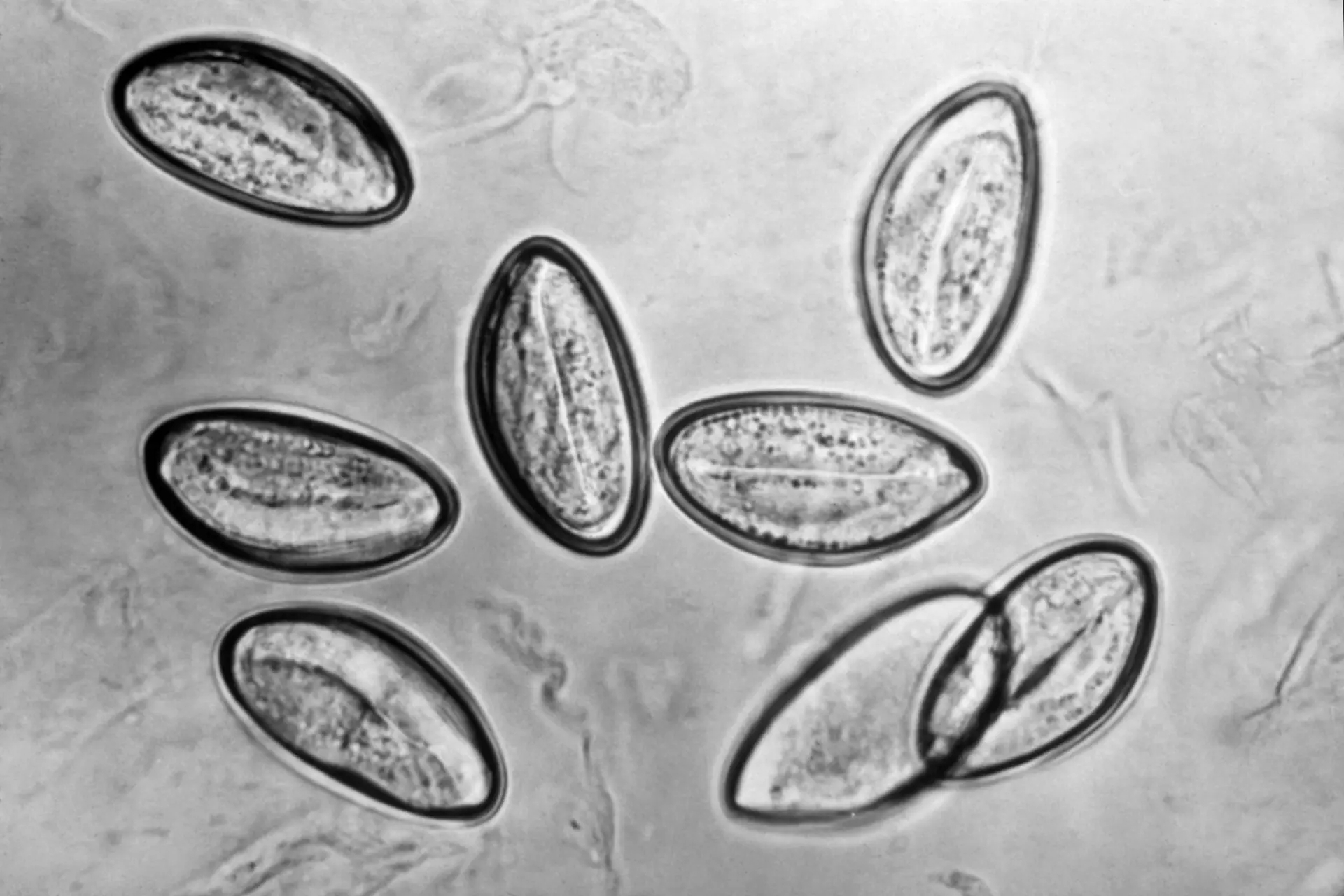 Яйца остриц (Enterobius vermicularis)