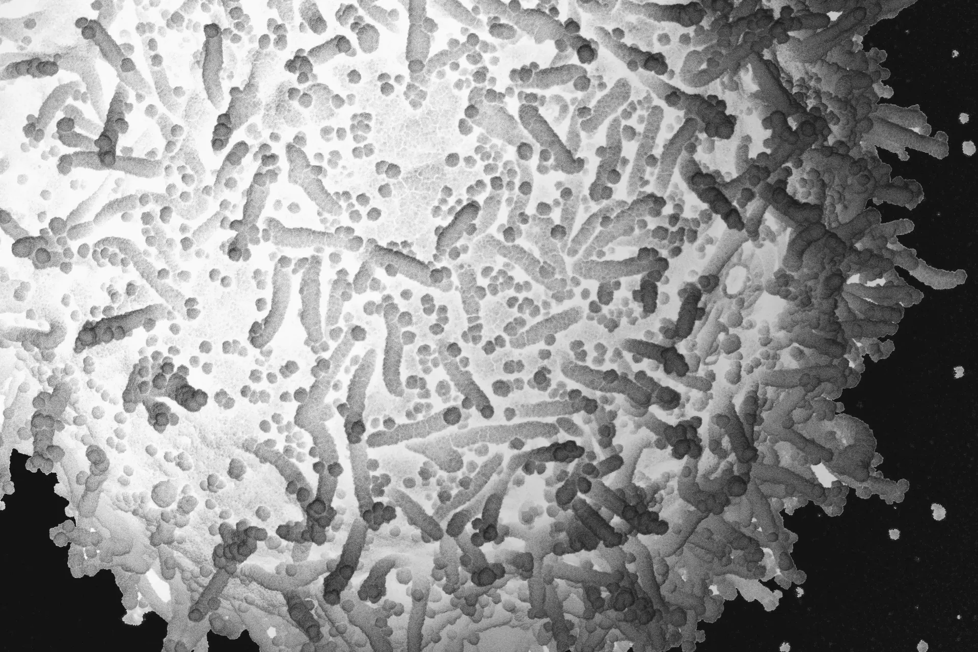 Микрофотография клетки, инфицированной частицами SARS-CoV-2